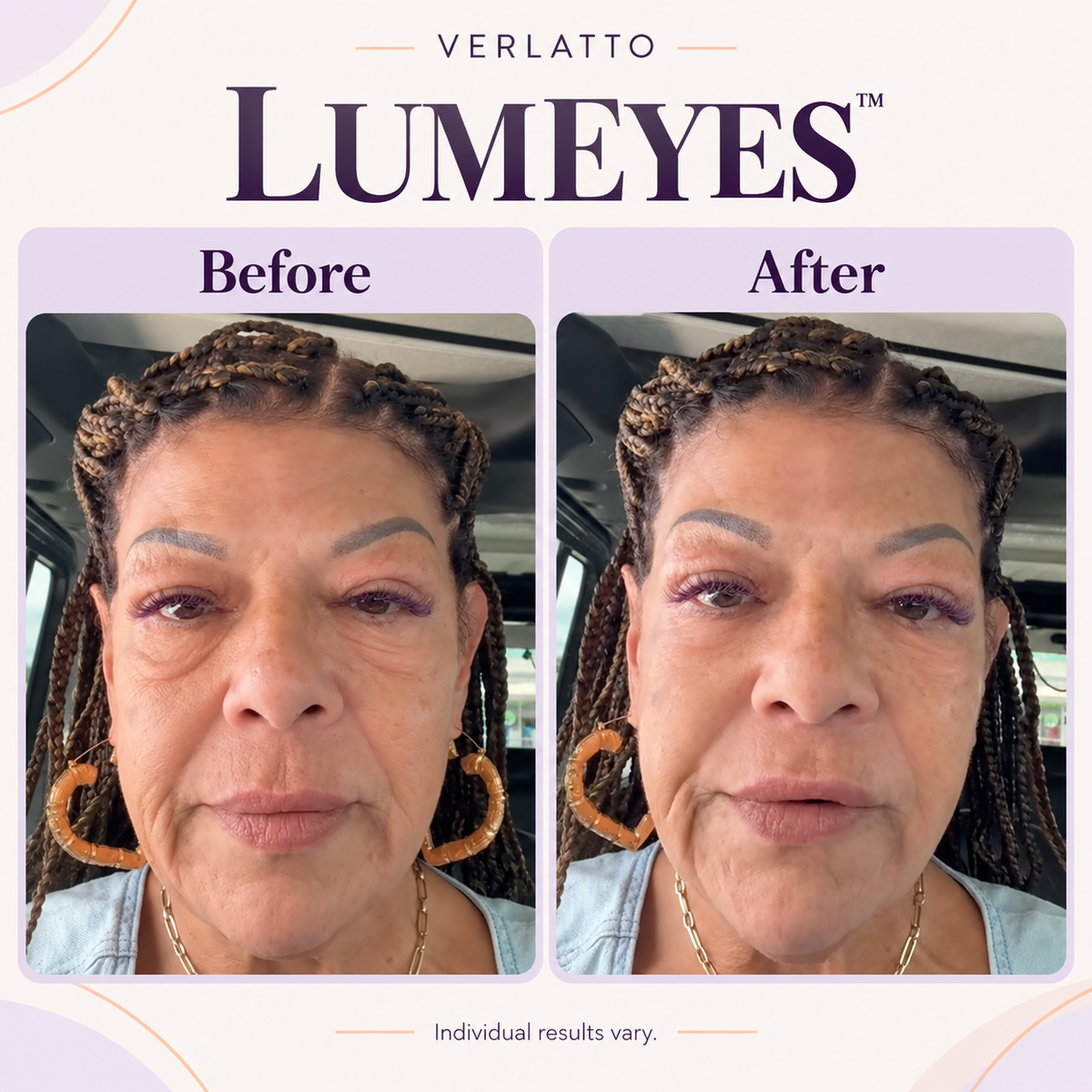 Lumeyes™ Eye Cream