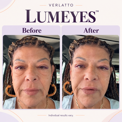 Lumeyes™ Eye Cream